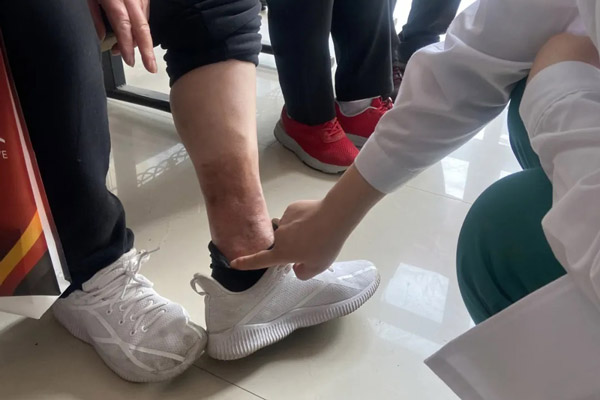 静脉曲张微创治疗手术后的护理与康复：沈阳静脉曲张专科如何通过有效的术后管理促进患者快速恢复